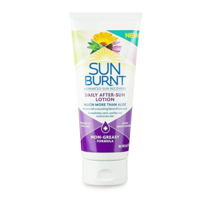 Best Products For Treating Sunburns